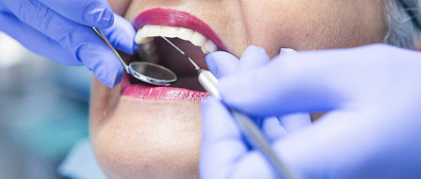 Best Emergency Treatment for Toothache in Caledonia, MN